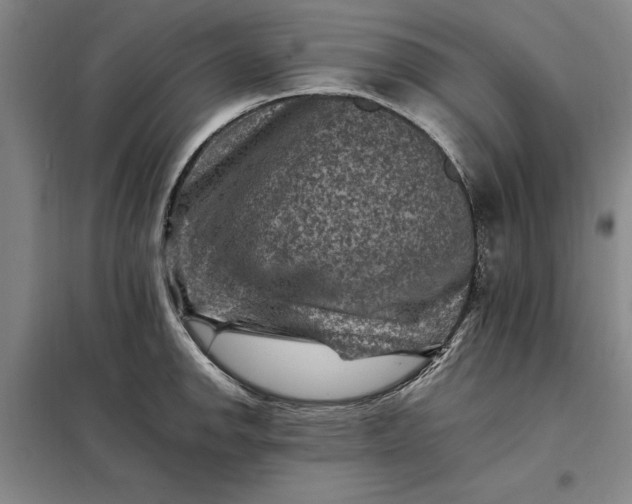 X0000098161142200805011425