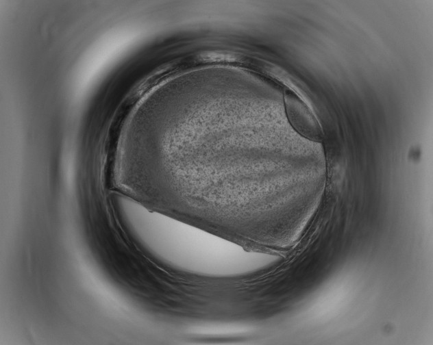 X0000098161151200805011425