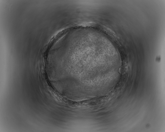 X0000098161158200805011424