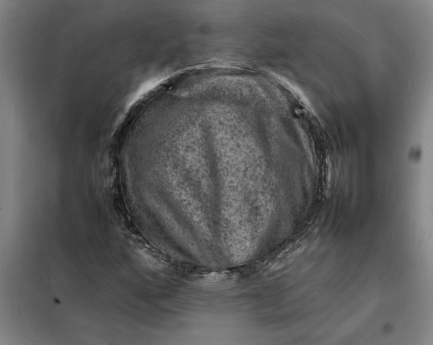 X0000098161160200805011424