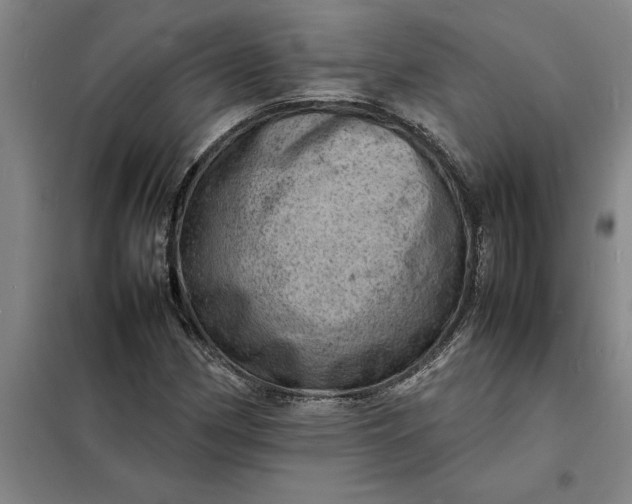 X0000098161162200805011424
