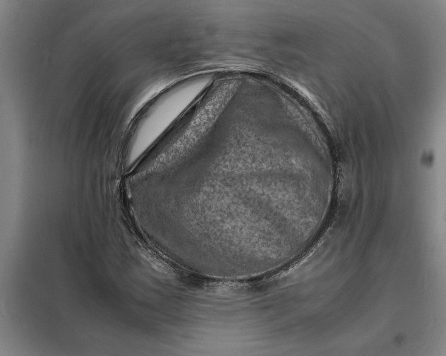 X0000098161163200805011424