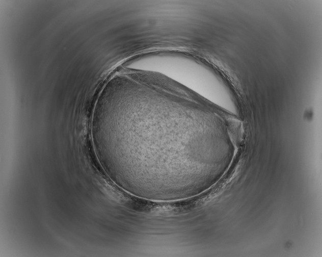 X0000098161169200805011424