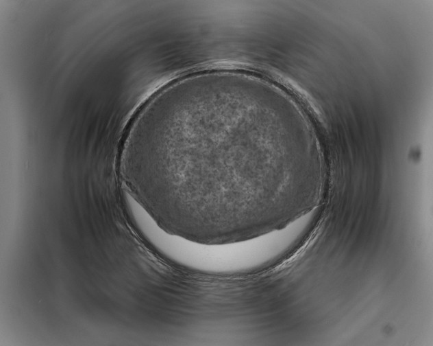 X0000098161170200805011424