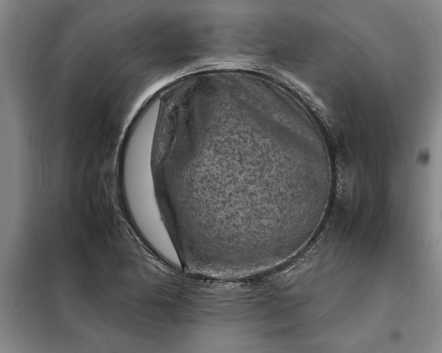 X0000098161174200805011423