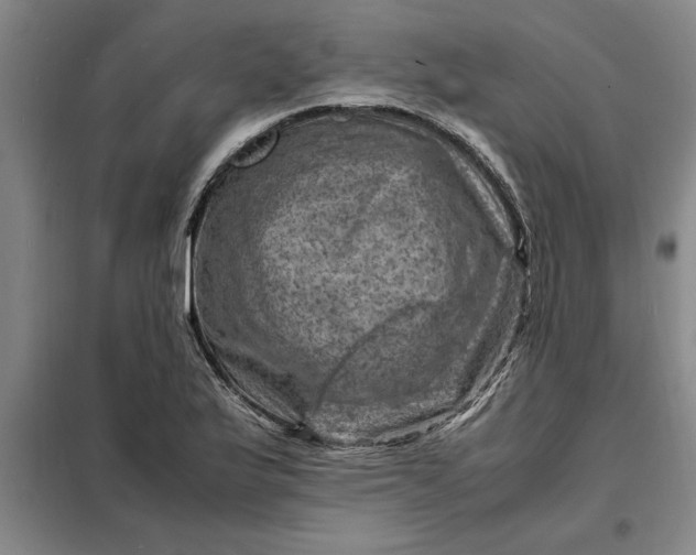 X0000098161175200805011423