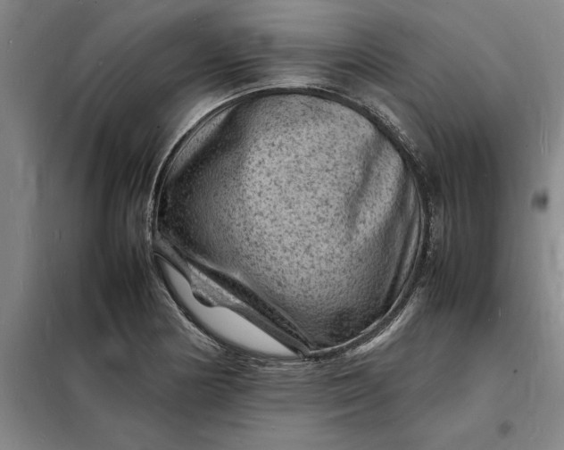 X0000098161178200805011423