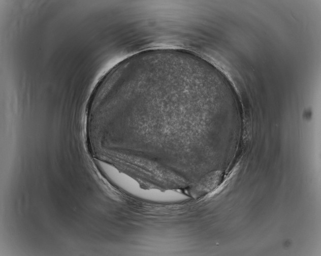 X0000098161179200805011423