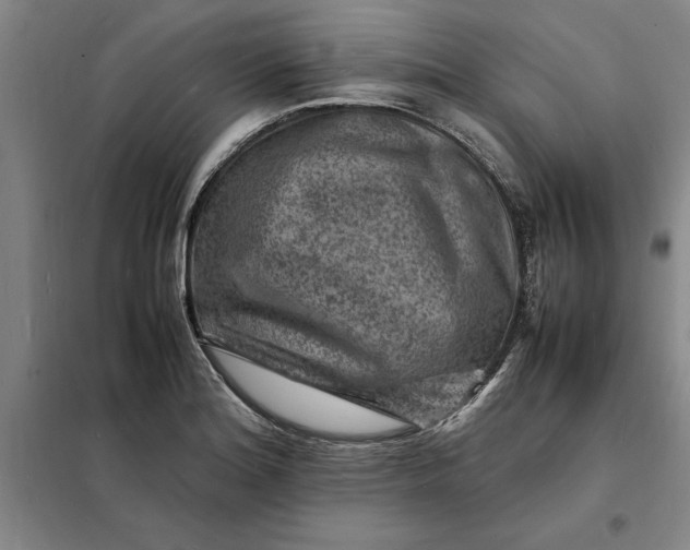 X0000098161180200805011423