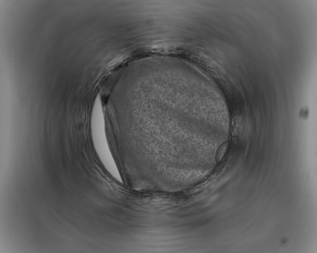 X0000098161202200805011422