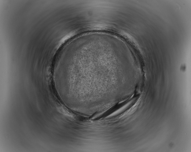 X0000098161210200805011422