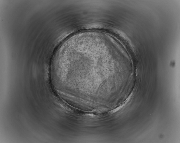 X0000098161217200805011423