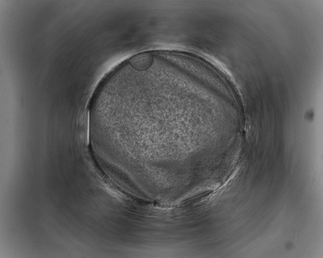 X0000098161223200805011423