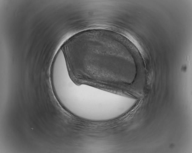 X0000098161283200805011422