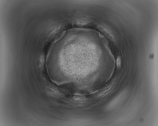 X0000098161299200805011421