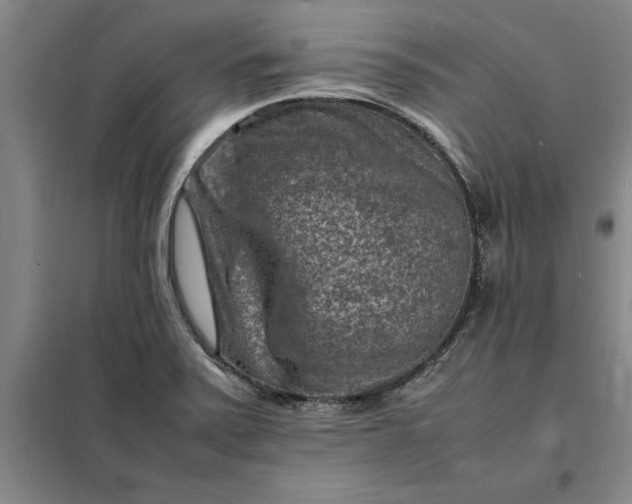 X0000098161371200805011421