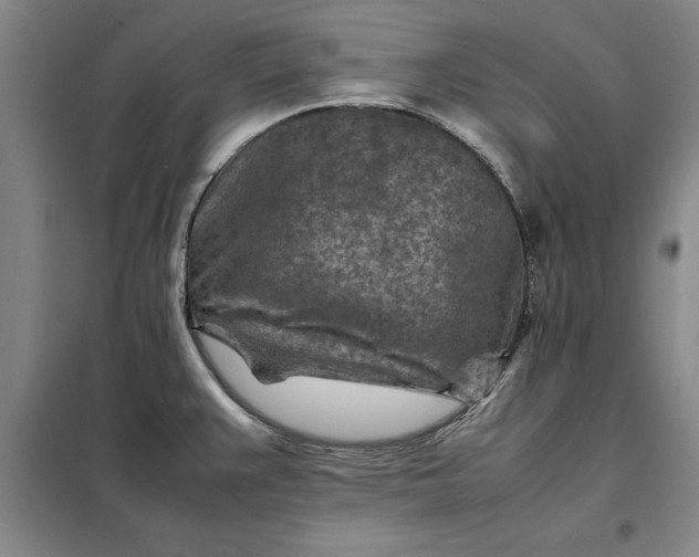 X0000098161383200805011420
