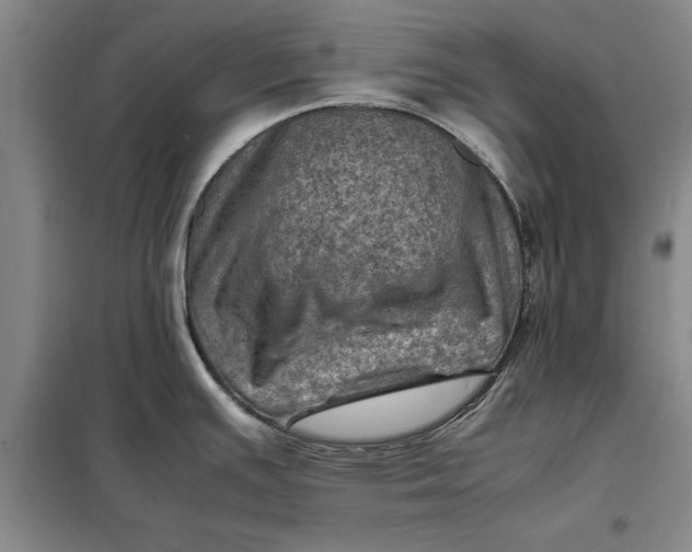 X0000098161391200805011420
