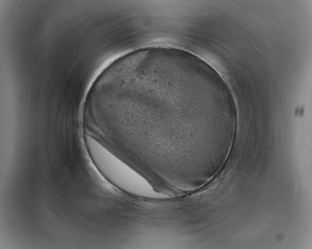 X0000098161392200805011420