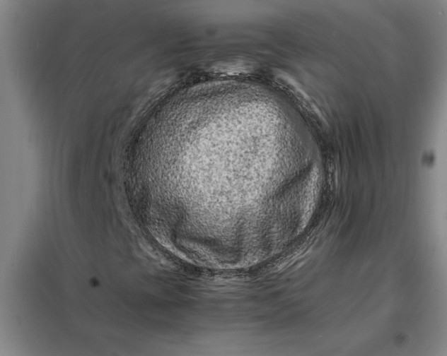 X0000098161393200805011419
