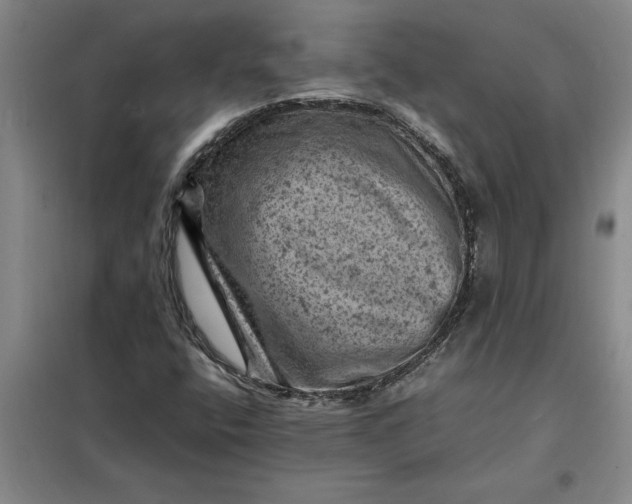 X0000098161400200805011420