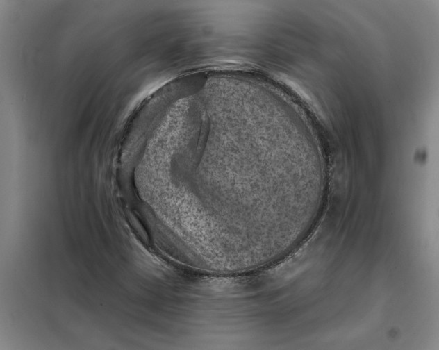 X0000098161402200805011420