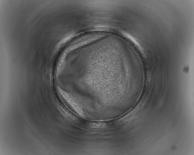 X0000098161403200805011420