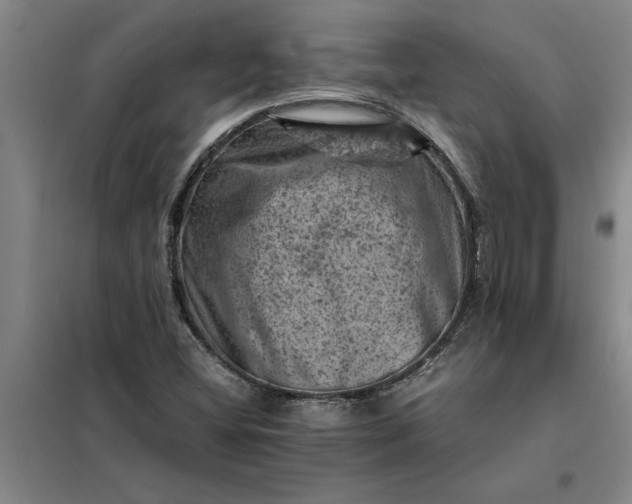 X0000098161404200805011420