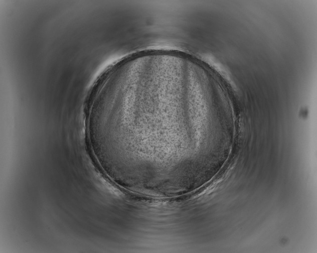X0000098161408200805011420