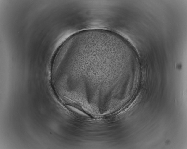 X0000098161415200805011420