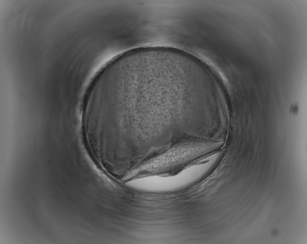 X0000098161416200805011420