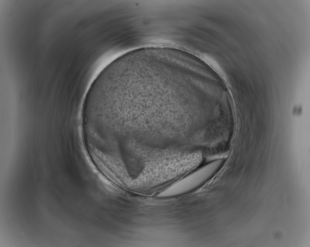 X0000098161440200805011420