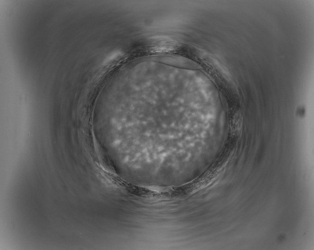 X0000098161441200805011419