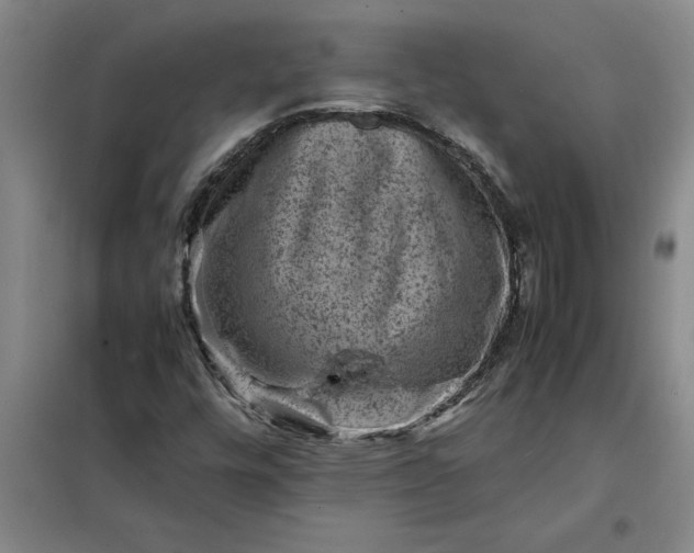 X0000098161448200805011419