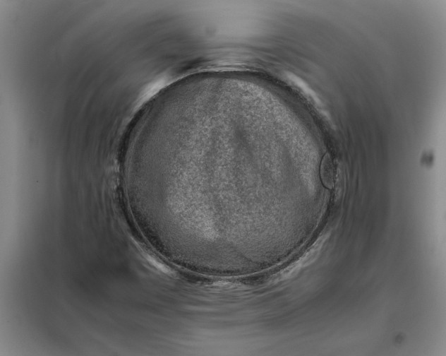 X0000098161449200805011419