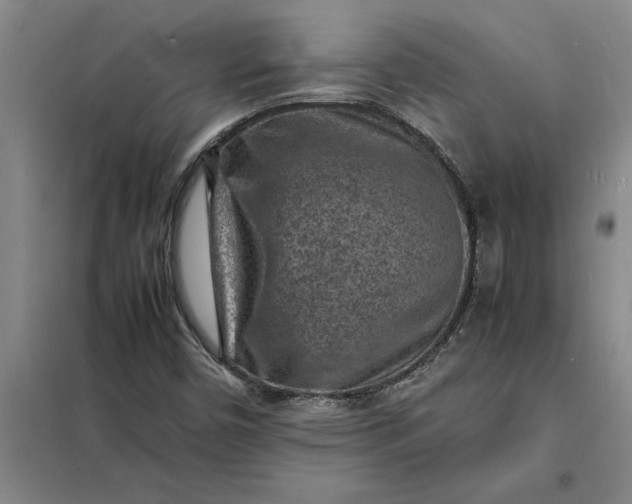 X0000098161450200805011419