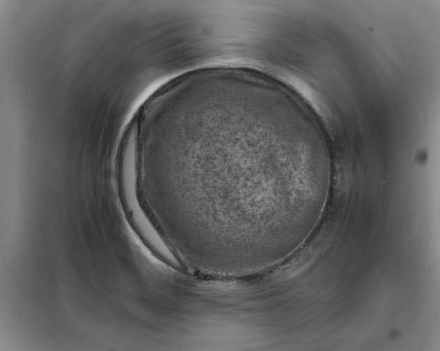 X0000098161468200805011419