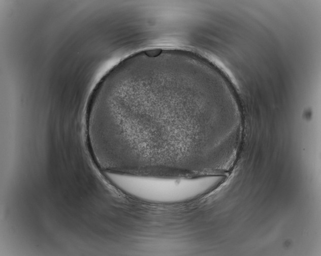 X0000098161469200805011419
