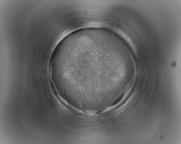 X0000098161473200805011419