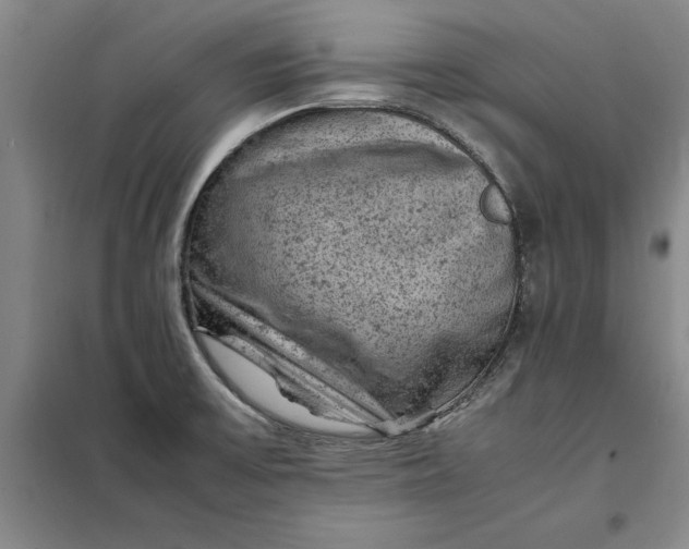 X0000098161475200805011419