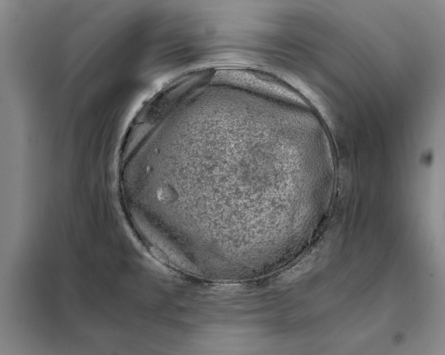 X0000098161477200805011419