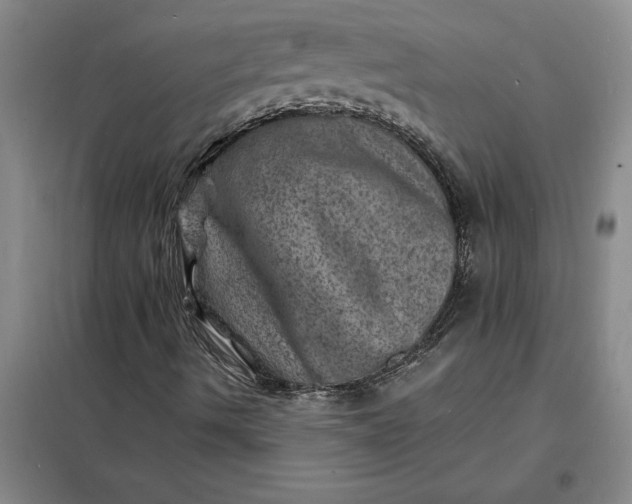 X0000098161490200805011418