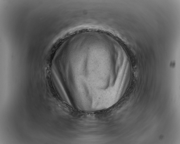 X0000098161495200805011418