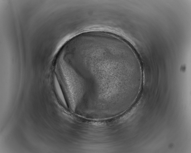 X0000098161501200805011418