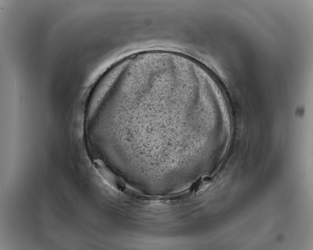 X0000098161504200805011418