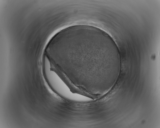 X0000098161515200805011419