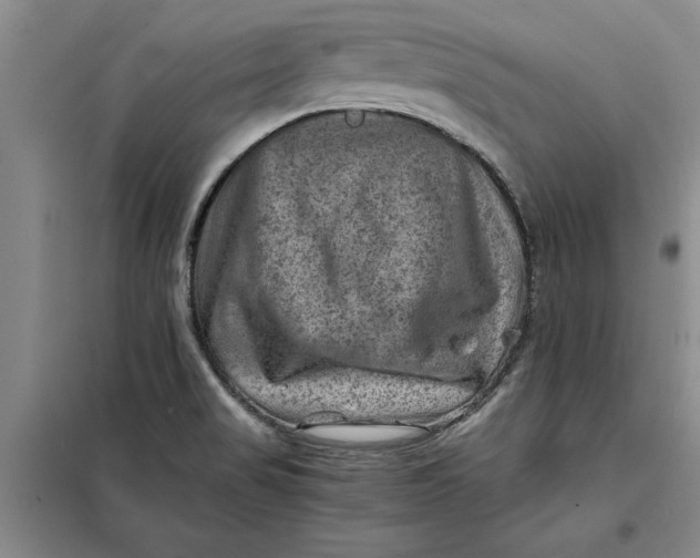 X0000098161517200805011419