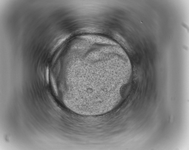 X0000098160014200805081114