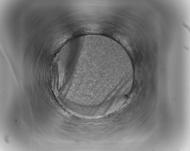 X0000098160017200805081114