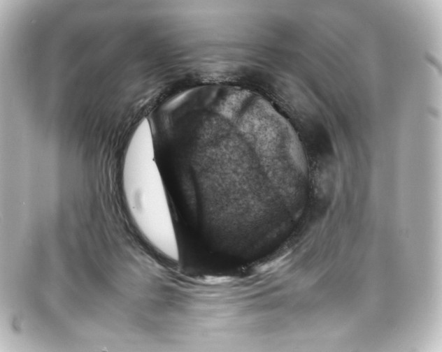 X0000098160219200805081111